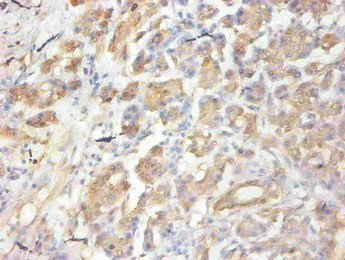 Anti-CCL2 Monoclonal, clone 3D2E5