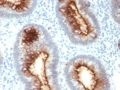 Anti-Carcinoembryonic Antigen (CEA) / CD66(Clone: C66/1030)