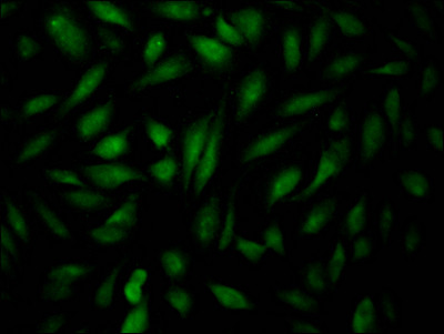 Anti-EPAS1 Recombinant Monoclonal, clone 6A9