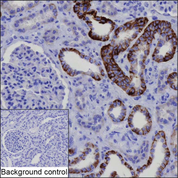 Anti-ATP1B1