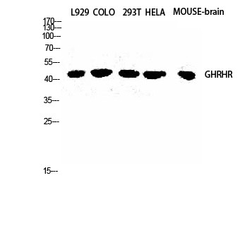 Anti-GHRH Receptor