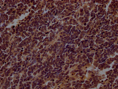 Anti-TERT Recombinant Monoclonal, clone 5C11