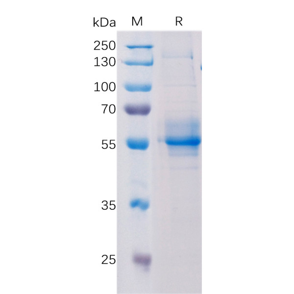 Human TMEM173 Protein, hFc Tag