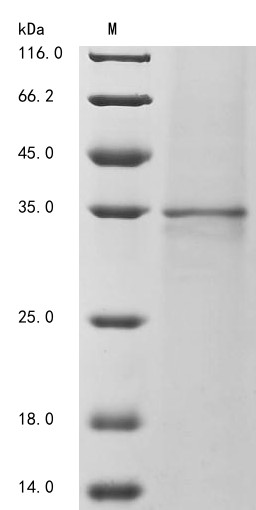 Ectonucleoside triphosphate diphosphohydrolase 1 (Entpd1), partial, rat, recombinant