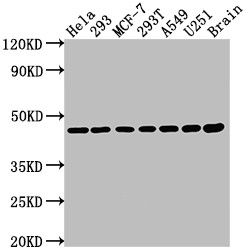 Anti-MAP2K1 Recombinant Monoclonal, clone 9B6