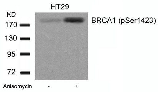 Anti-Phospho-BRCA1 (Ser1423)