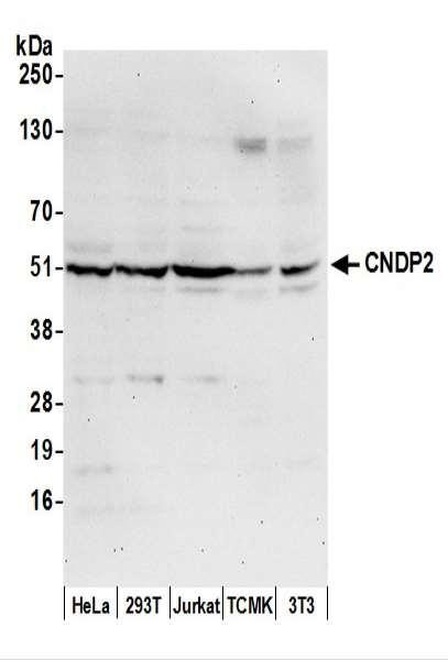 Anti-CNDP2