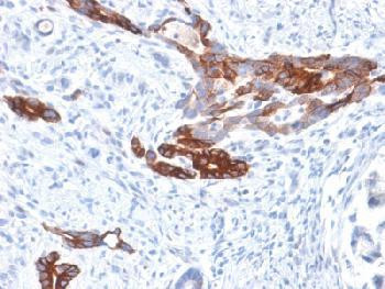 Anti-MUC6 (Mucin 6 / Gastric Mucin) Recombinant Rabbit Monoclonal Antibody (clone:MUC6/1553R)