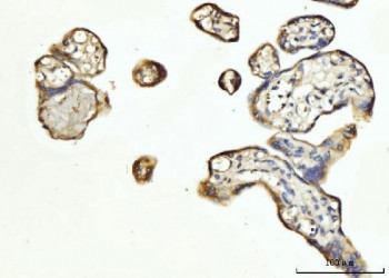 Anti-FGF3 / Fibroblast growth factor 3