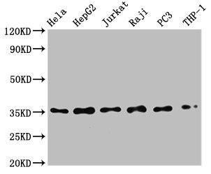 Anti-NFKBIA Recombinant Monoclonal, clone 1E9