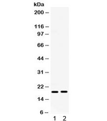 Anti-IP10 / CXCL10