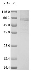 Receptor-interacting serine/threonine-protein kinase 3 (Ripk3), rat, recombinant