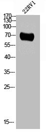 Anti-Phospho-CAMK2B/CAMK2G/CAMK2D (T287)