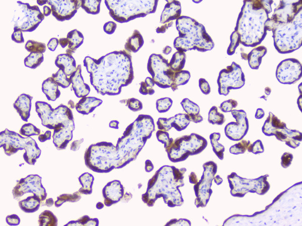 Anti-CYP19A1 / Aromatase