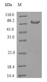 Receptor-interacting serine/threonine-protein kinase 3 (RIPK3), human, recombinant