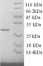 Tryptase (Tpsab1), partial, mouse, recombinant