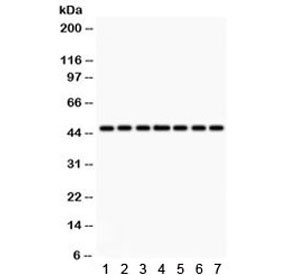 Anti-IDH1