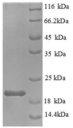 Interleukin-1 beta (Il1b), partial, mouse, recombinant