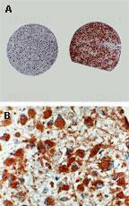 Anti-Caspase 8 ( active/cleaved )