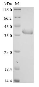 Fructose-bisphosphate aldolase C (ALDOC), human, recombinant