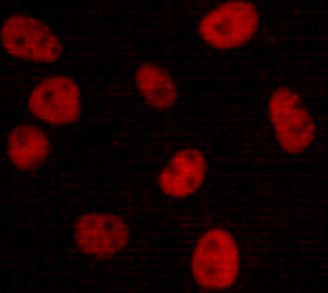 Anti-DNA-PKcs, clone 6D1-C11-F10