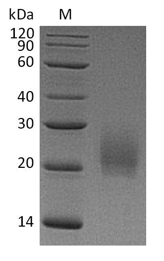 Cytotoxic T-lymphocyte protein 4 (Ctla4), partial (Active), mouse, recombinant