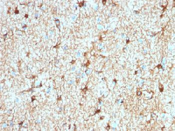 Anti-GFAP (Astrocyte &amp; Neural Stem Cell Marker) Recombinant Rabbit Monoclonal Antibody (clone:ASTRO/