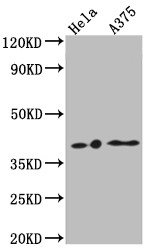 Anti-LPAR1 Recombinant Monoclonal, clone 4C3