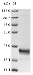 Fatty acid-binding protein (FABP5), human, recombinant