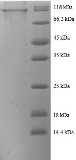 Catenin beta-1 (CTNNB1), human, recombinant