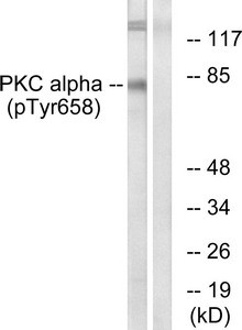 Anti-Phospho-PRKCA (Tyr658)