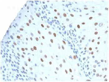 Anti-p21WAF1 (Tumor Suppressor Protein) Recombinant Rabbit Monoclonal Antibody (clone:CIP1/2275R)