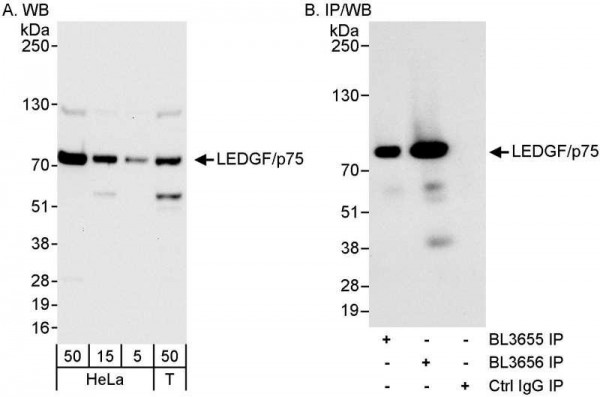 Anti-LEDGF/p75