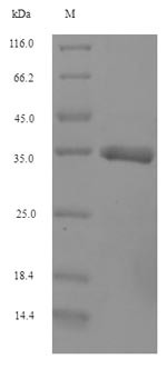 Interferon alpha-G (IFNAG), bovine, recombinant