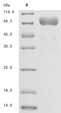 Mesothelin (MSLN), partial, human, recombinant