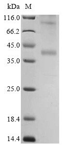 C-C chemokine receptor type 4 (CCR4) (Active), human, recombinant