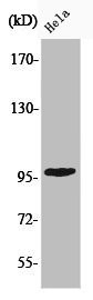 Anti-Phospho-CHEK2 (T68)