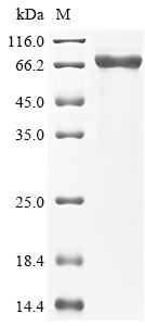 Desmoglein-2 (DSG2), partial, human, recombinant