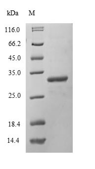 DNA-dependent protein kinase catalytic subunit (Prkdc), partial, mouse, recombinant