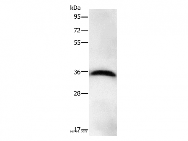 Anti-PPP1CB