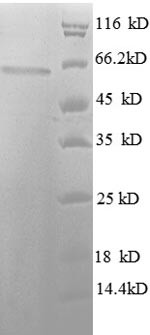 Histone deacetylase 3 (HDAC3), human, recombinant