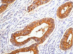 Anti-CEACAM5 Monoclonal