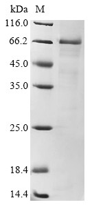 Toll-like receptor 4 (TLR4), partial, human, recombinant