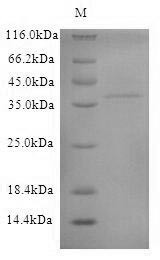 Anionic trypsin, dog, recombinant