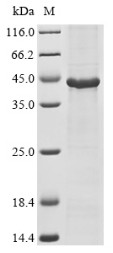 Acyl-CoA desaturase 1 (Scd1), mouse, recombinant