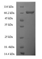 Thyroid hormone receptor beta (THRB), human, recombinant