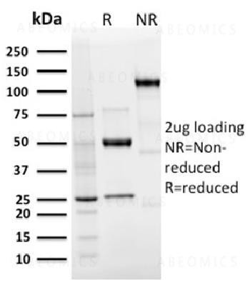 Anti-Langerin / CD207 (Marker of Langerhans Cells) Monoclonal Antibody (Clone: LGRN/3136R)