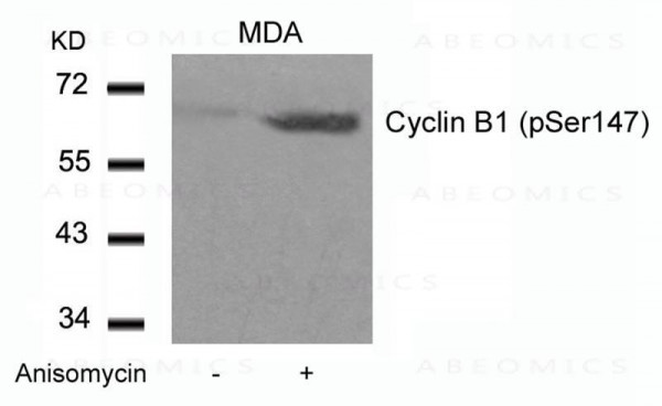 Anti-Cyclin B1 (phospho-Ser147)