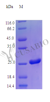 Galectin-3 protein (LGALS3) (Active), human, recombinant