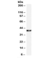 Anti-XLF / XRCC4-like factor